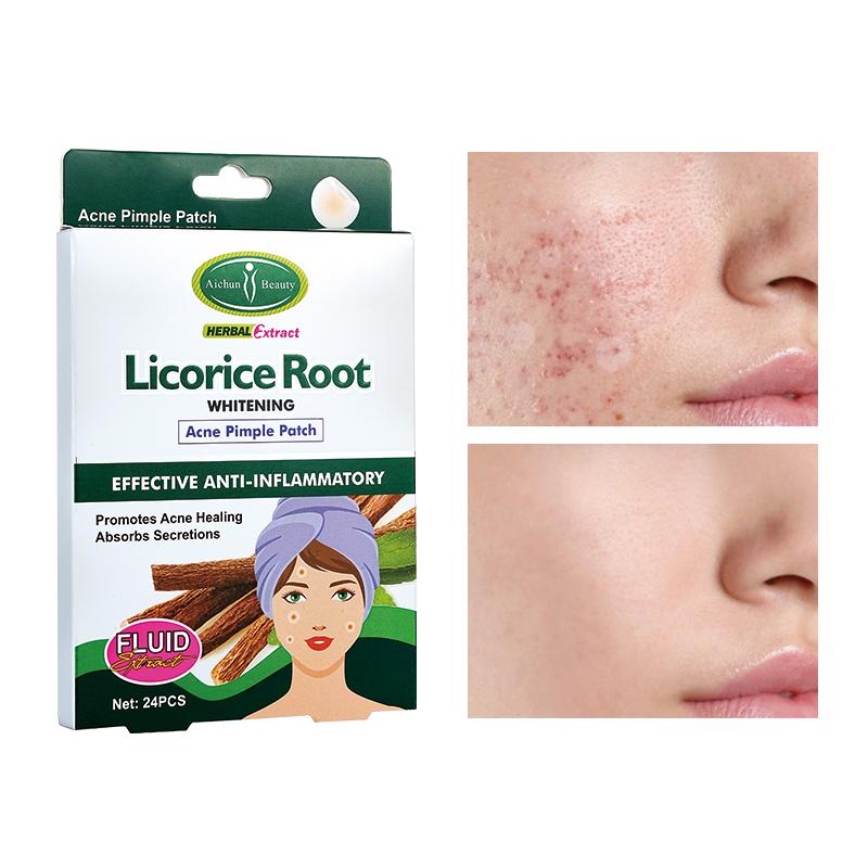 ПРИСТРОЙ!!![AICHUN BEAUTY] Патчи для лица против акне ЭКСТРАКТ КОРНЯ СОЛОДКИ Licorice Root Acne, 24 шт